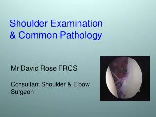 Shoulder Examination &amp; Common Pathology