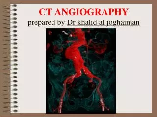 CT ANGIOGRAPHY prepared by Dr khalid al joghaiman