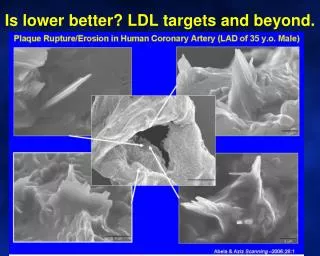 Is lower better? LDL targets and beyond.