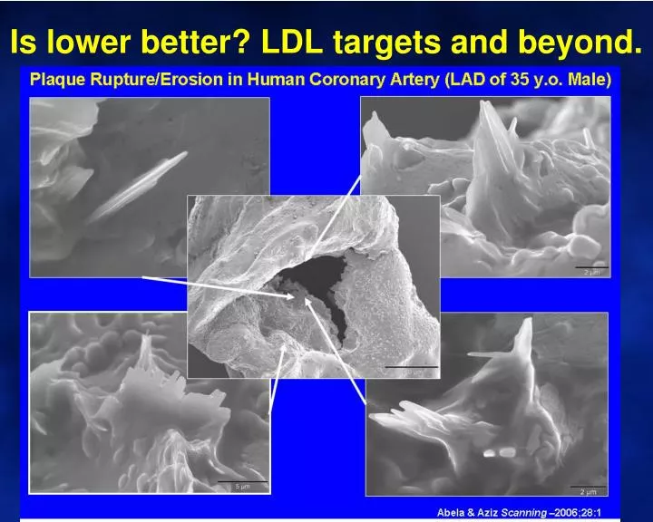 is lower better ldl targets and beyond