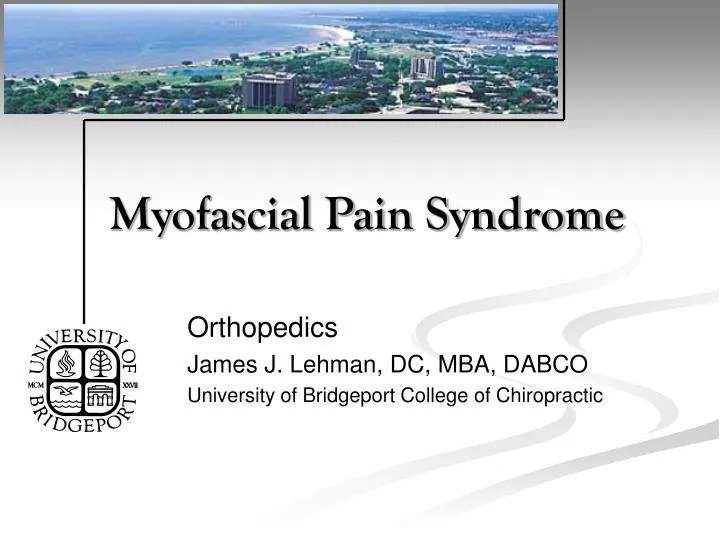 myofascial pain syndrome