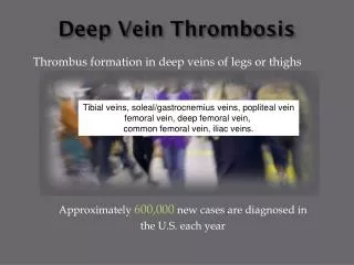 Deep Vein Thrombosis