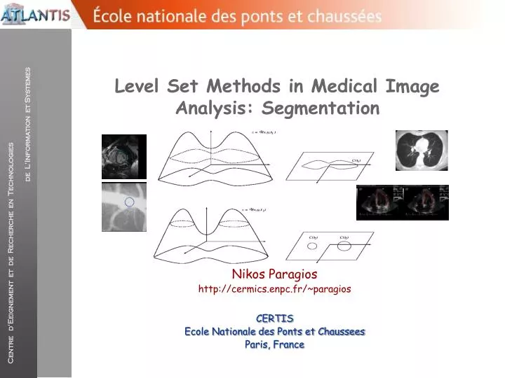 level set methods in medical image analysis segmentation