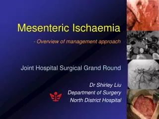 Mesenteric Ischaemia - Overview of management approach