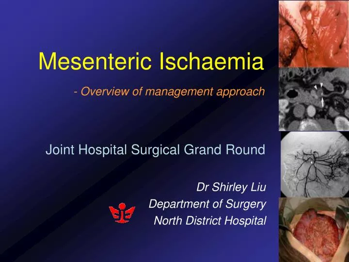 mesenteric ischaemia overview of management approach