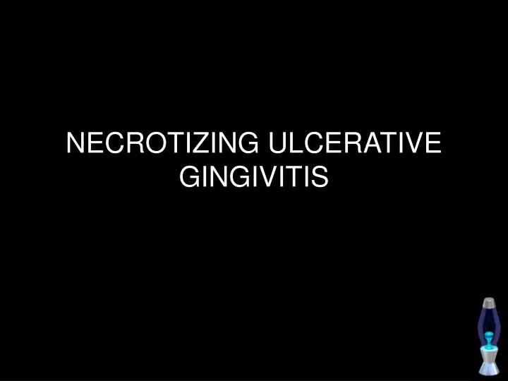 necrotizing ulcerative gingivitis