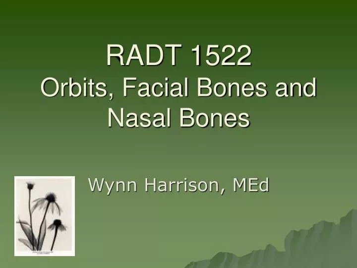 radt 1522 orbits facial bones and nasal bones