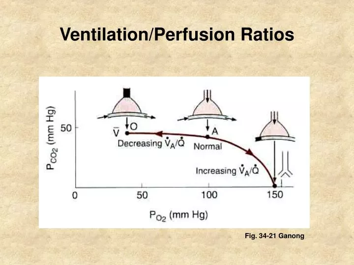 ventilation perfusion ratios
