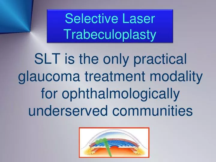 selective laser trabeculoplasty