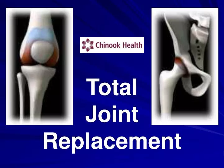 total joint replacement