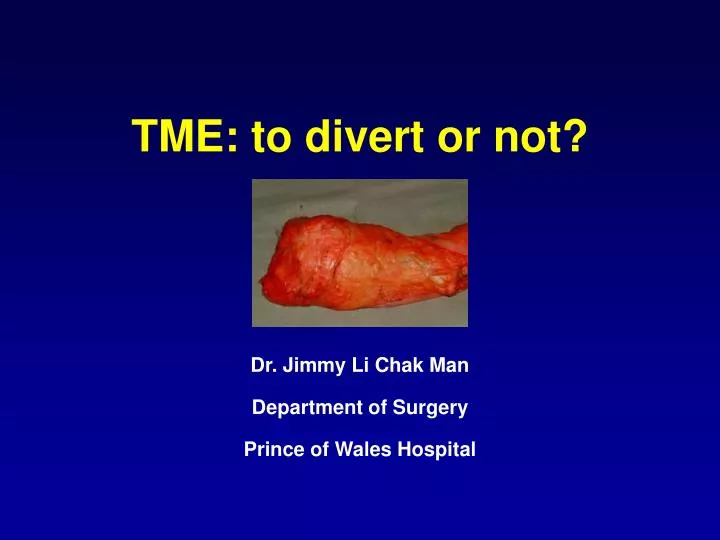 tme to divert or not