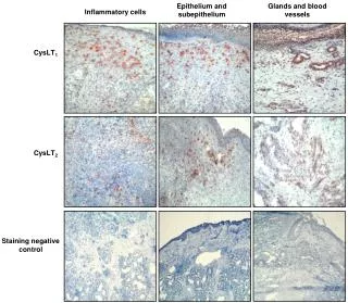 CysLT 1