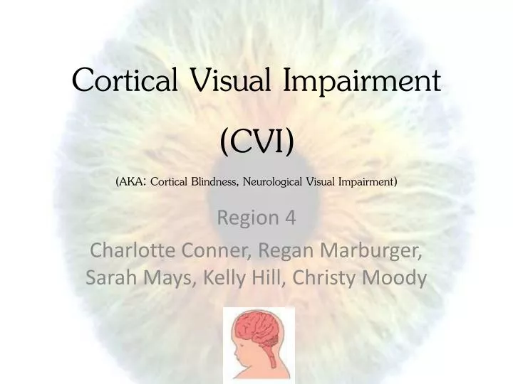 cortical visual impairment cvi aka cortical blindness neurological visual impairment