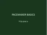 PACEMAKER BASICS