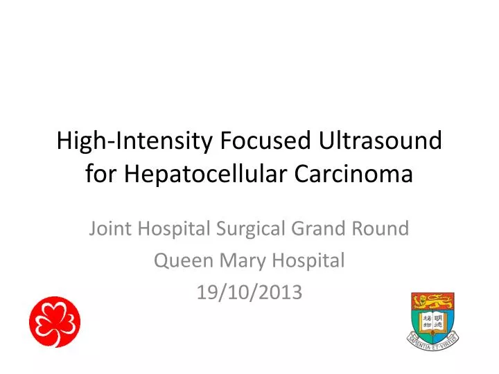 high intensity focused ultrasound for hepatocellular carcinoma
