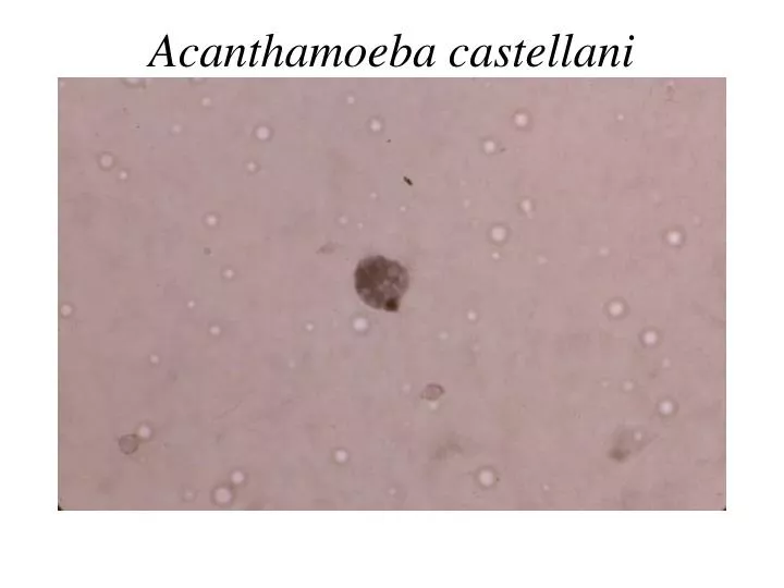 acanthamoeba castellani