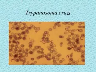 trypanosoma cruzi