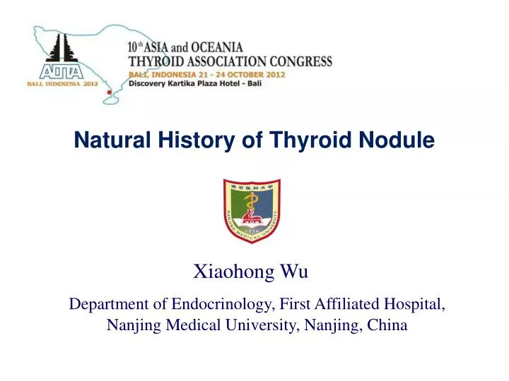 natural history of thyroid nodule