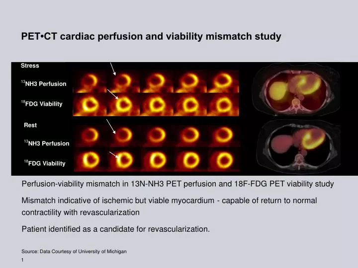 pet ct cardiac perfusion and viability mismatch study