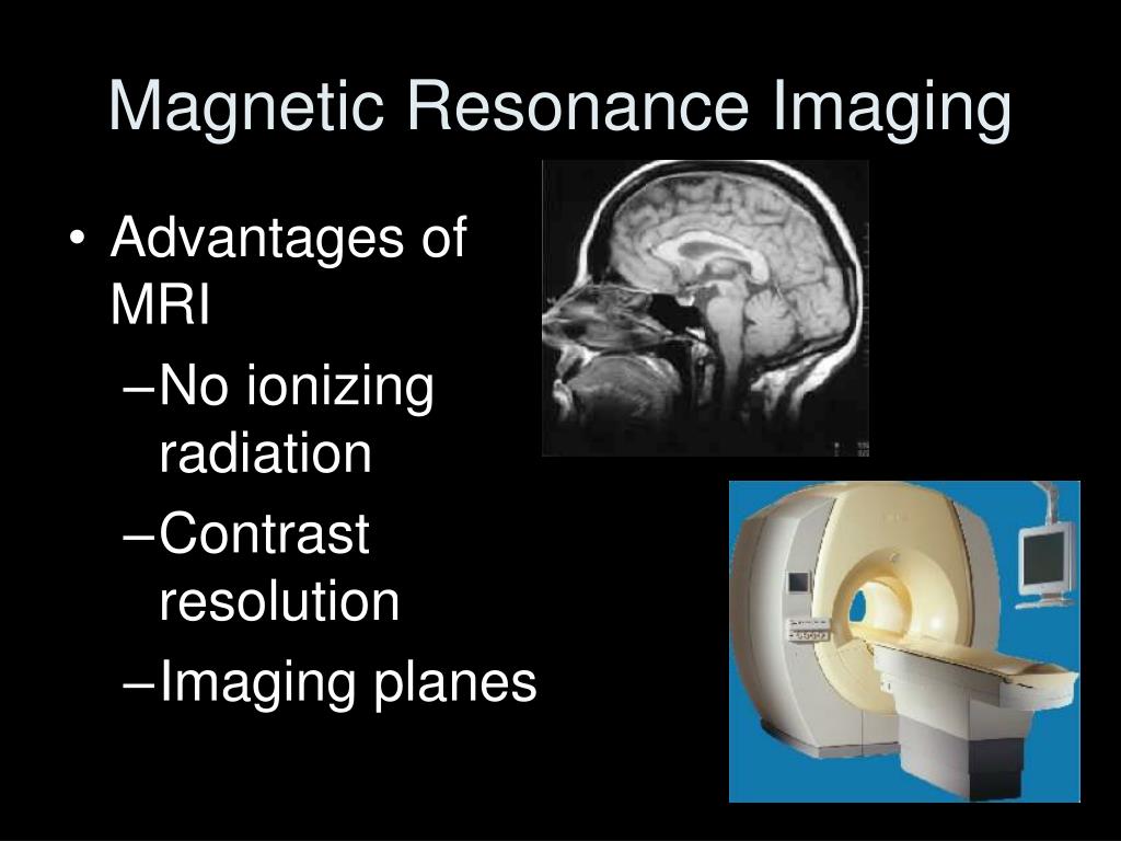 PPT - Magnetic Resonance Imaging PowerPoint Presentation, free download ...
