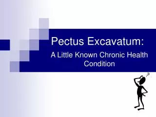 Pectus Excavatum: