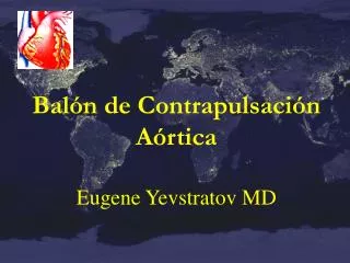 bal n de contrapulsaci n a rtica eugene yevstratov md