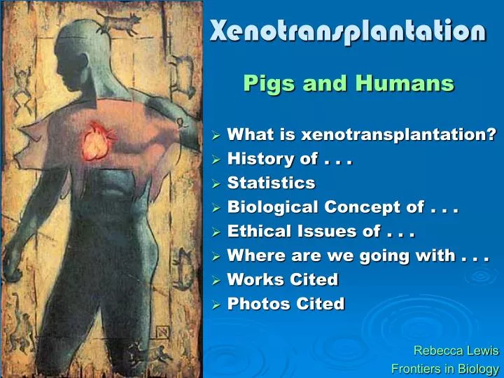 xenotransplantation