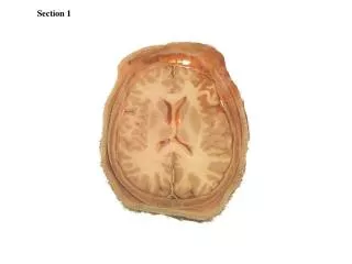 section 1