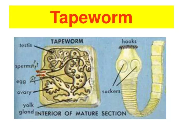 tapeworm