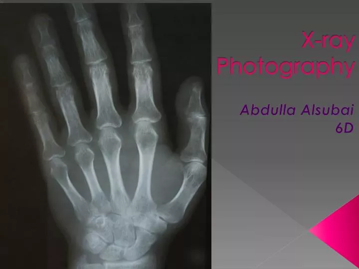 x ray photography