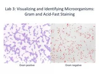 Lab 3: Visualizing and Identifying Microorganisms: Gram and Acid-Fast Staining