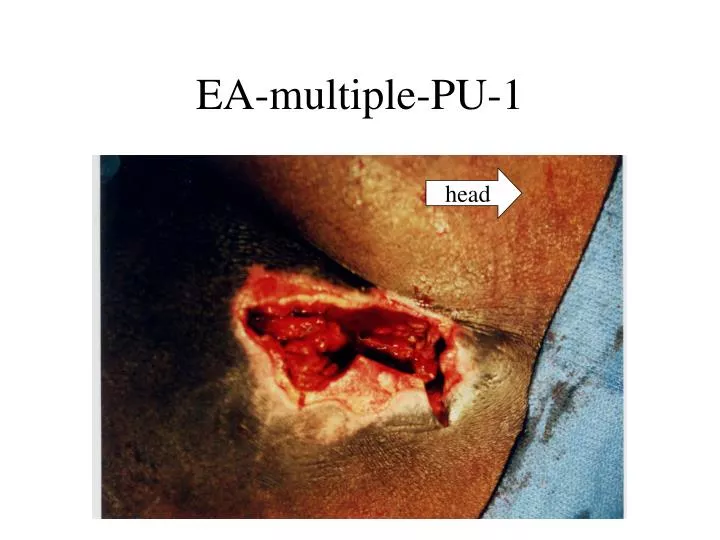 ea multiple pu 1