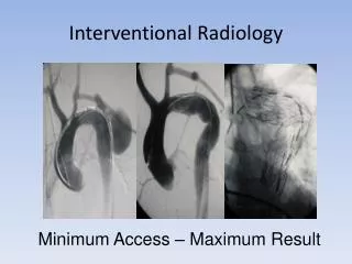 Interventional Radiology