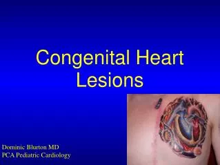 Congenital Heart Lesions