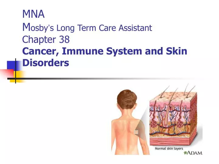 mna m osby s long term care assistant chapter 38 cancer immune system and skin disorders