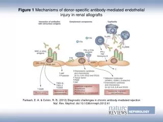 Figure 1 Mechanisms of donor-specific antibody-mediated endothelial injury in renal allografts