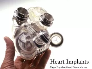 Heart Implants