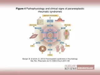 Figure 4 Pathophysiology and clinical signs of paraneoplastic rheumatic syndromes