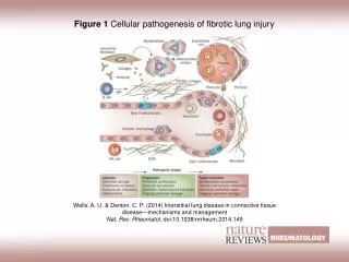 Figure 1 Cellular pathogenesis of fibrotic lung injury