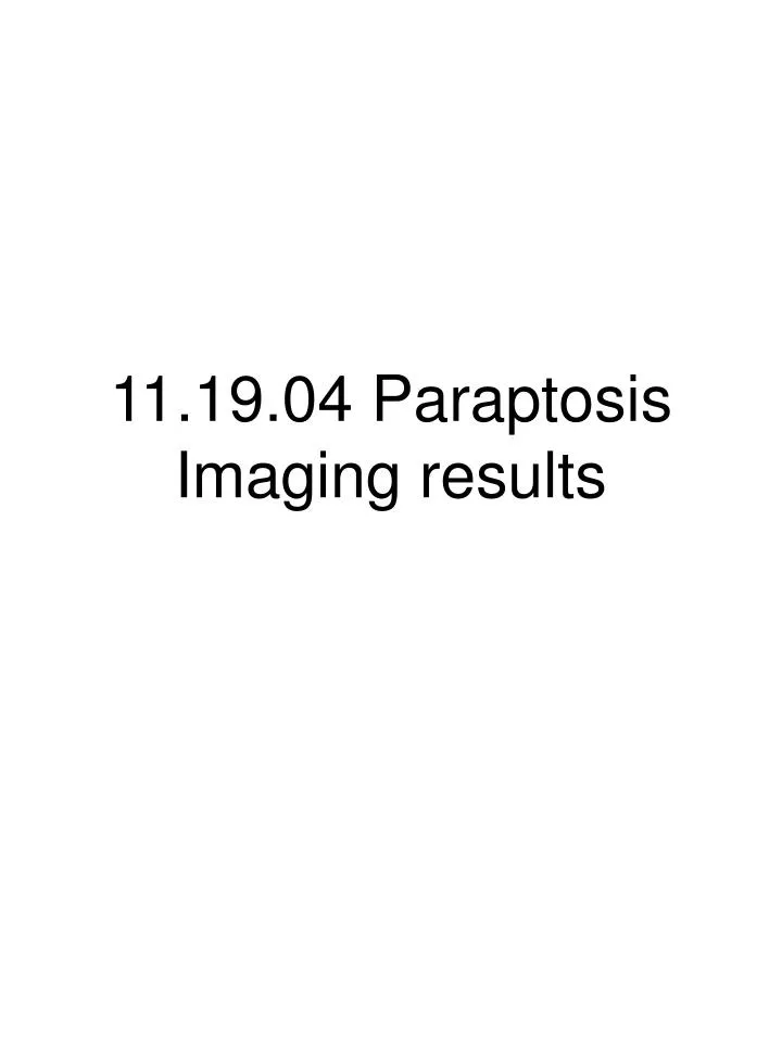 11 19 04 paraptosis imaging results