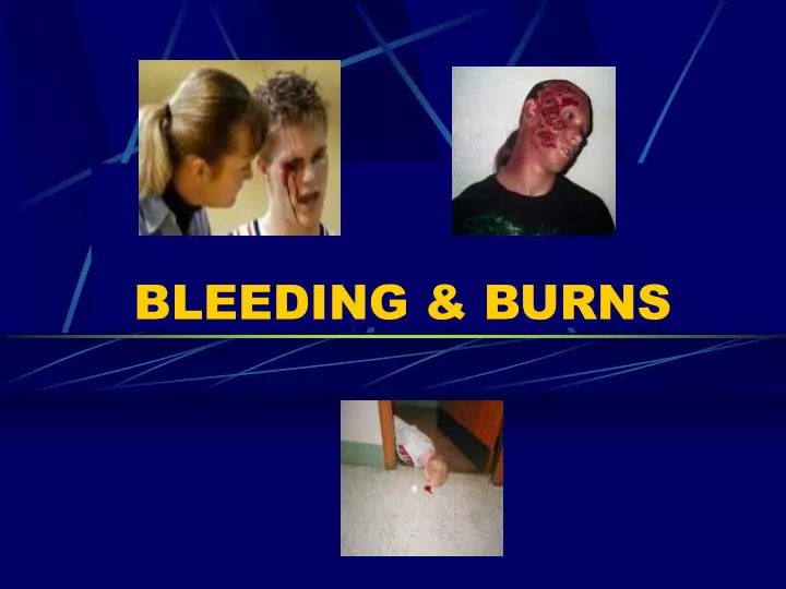 bleeding burns