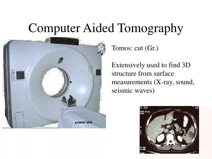 computer aided tomography