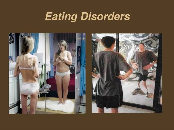 eating disorders