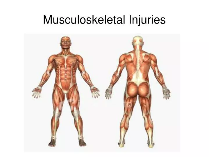 musculoskeletal injuries