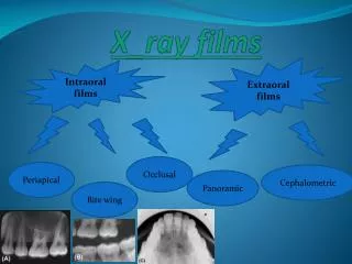 X _ray films
