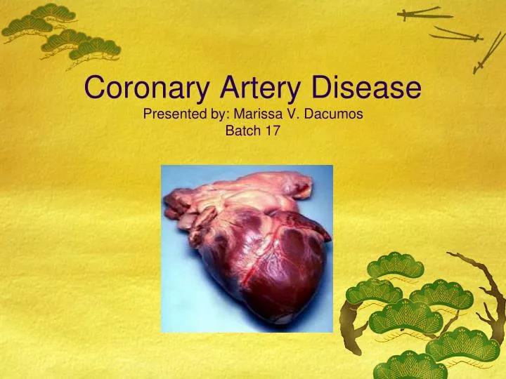 coronary artery disease presented by marissa v dacumos batch 17