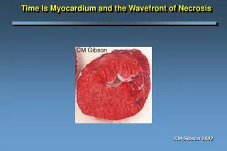 time is myocardium and the wavefront of necrosis