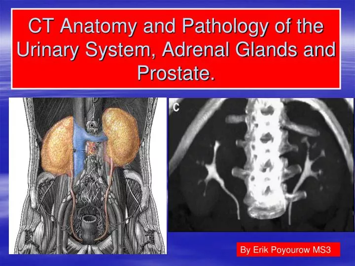 ct anatomy and pathology of the urinary system adrenal glands and prostate