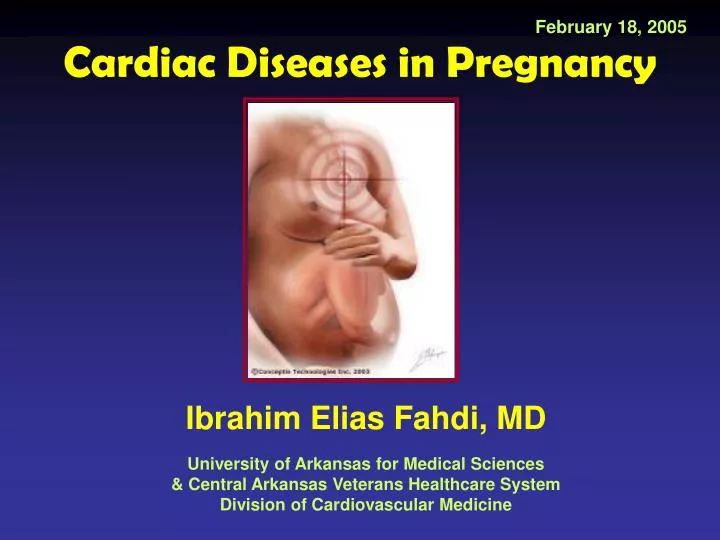 cardiac diseases in pregnancy