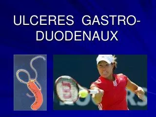ulceres gastro duodenaux